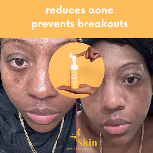 Turmeric & Kojic Acid Glow Wash