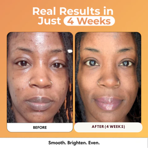 Turmeric & Kojic Acid Glow Wash